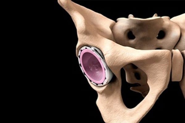 operation hanche prothese dr Abdellah Maidine chirurgien specialiste orthopediste et traumatologue chirurgie orthopedique Agadir operation hanche prothese dr Abdellah Maidine chirurgien specialiste orthopediste et traumatologue chirurgie orthopedique Agadir
