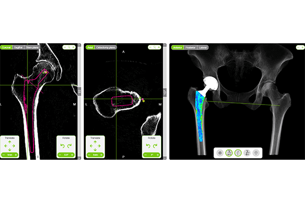 articulation du genou dr Abdellah Maidine chirurgien specialiste orthopediste et traumatologue chirurgie orthopedique Agadir articulation du genou dr Abdellah Maidine chirurgien specialiste orthopediste et traumatologue chirurgie orthopedique Agadir