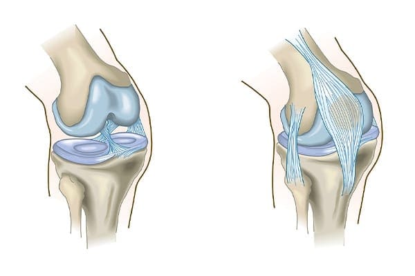 articulation du genou dr Abdellah Maidine chirurgien specialiste orthopediste et traumatologue chirurgie orthopedique Agadir