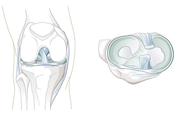 articulation du genou dr Abdellah Maidine chirurgien specialiste orthopediste et traumatologue chirurgie orthopedique Agadir articulation du genou dr Abdellah Maidine chirurgien specialiste orthopediste et traumatologue chirurgie orthopedique Agadir