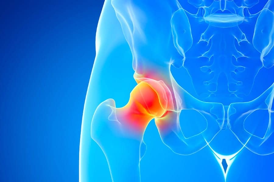 arthrose de la hanche docteur Abdellah Maidine chirurgien specialiste orthopediste et traumatologue chirurgie orthopedique Agadir arthrose de la hanche docteur Abdellah Maidine chirurgien specialiste orthopediste et traumatologue chirurgie orthopedique Agadir
